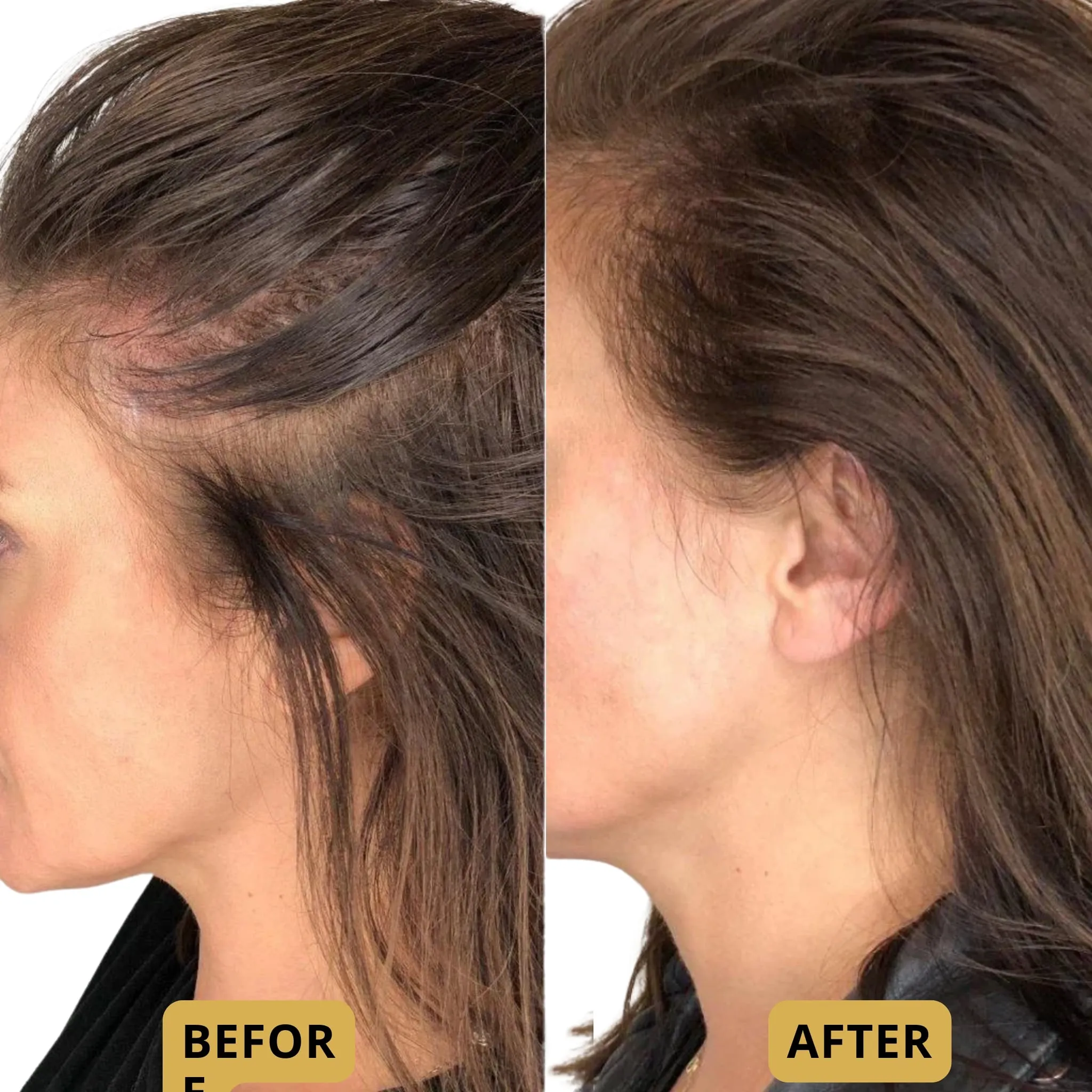 The Glow Thermal Scalp Massager™