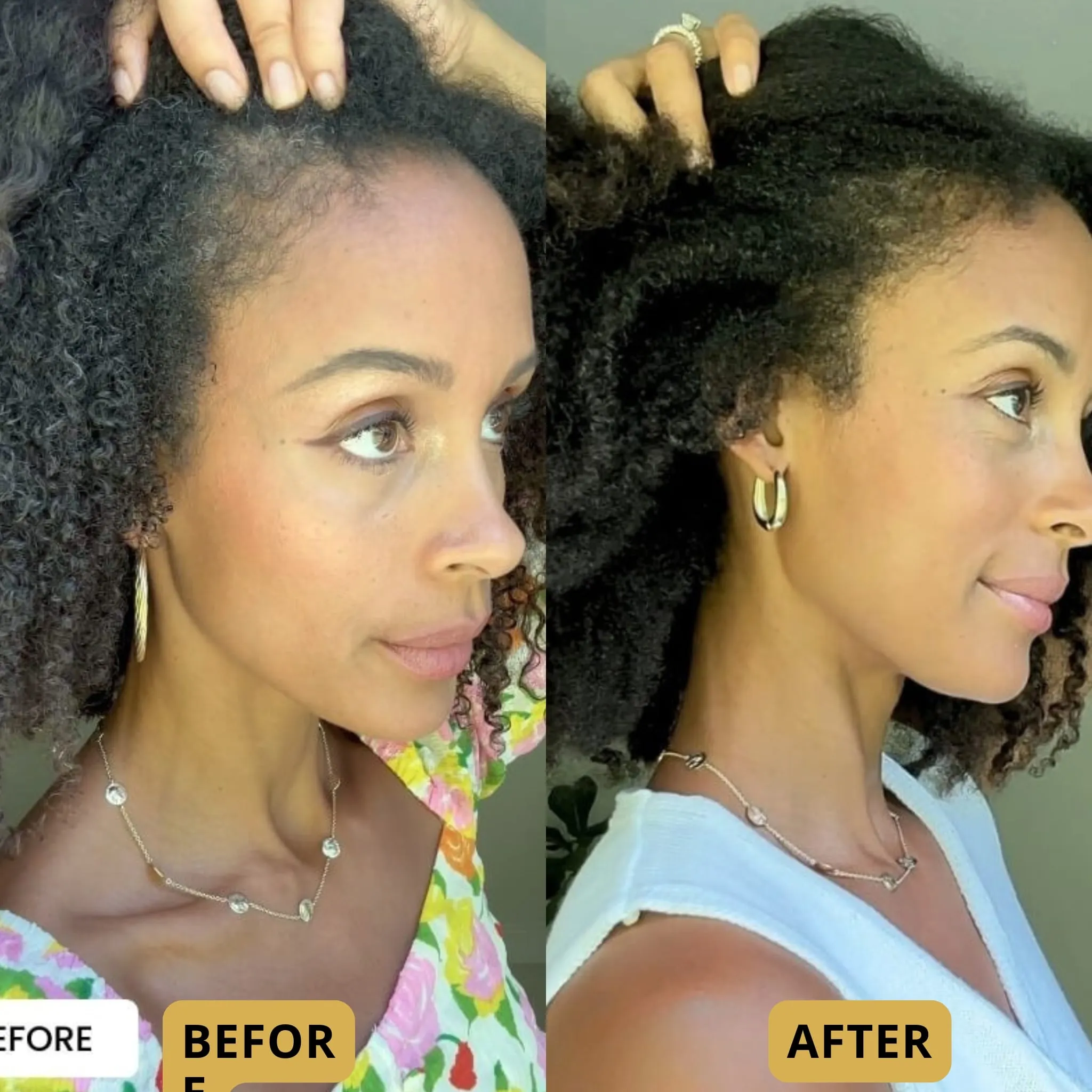 The Glow Thermal Scalp Massager™