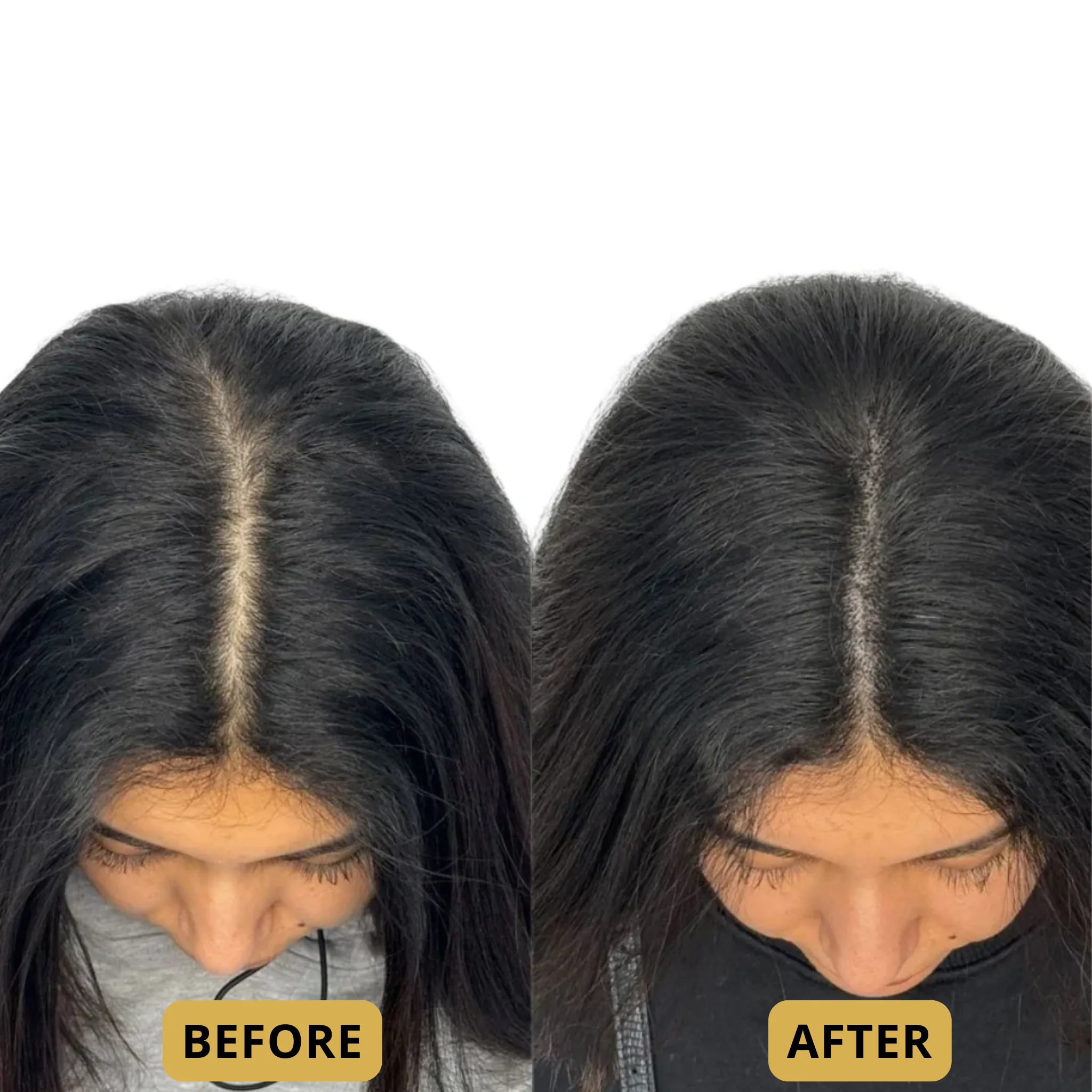 The Glow Thermal Scalp Massager™