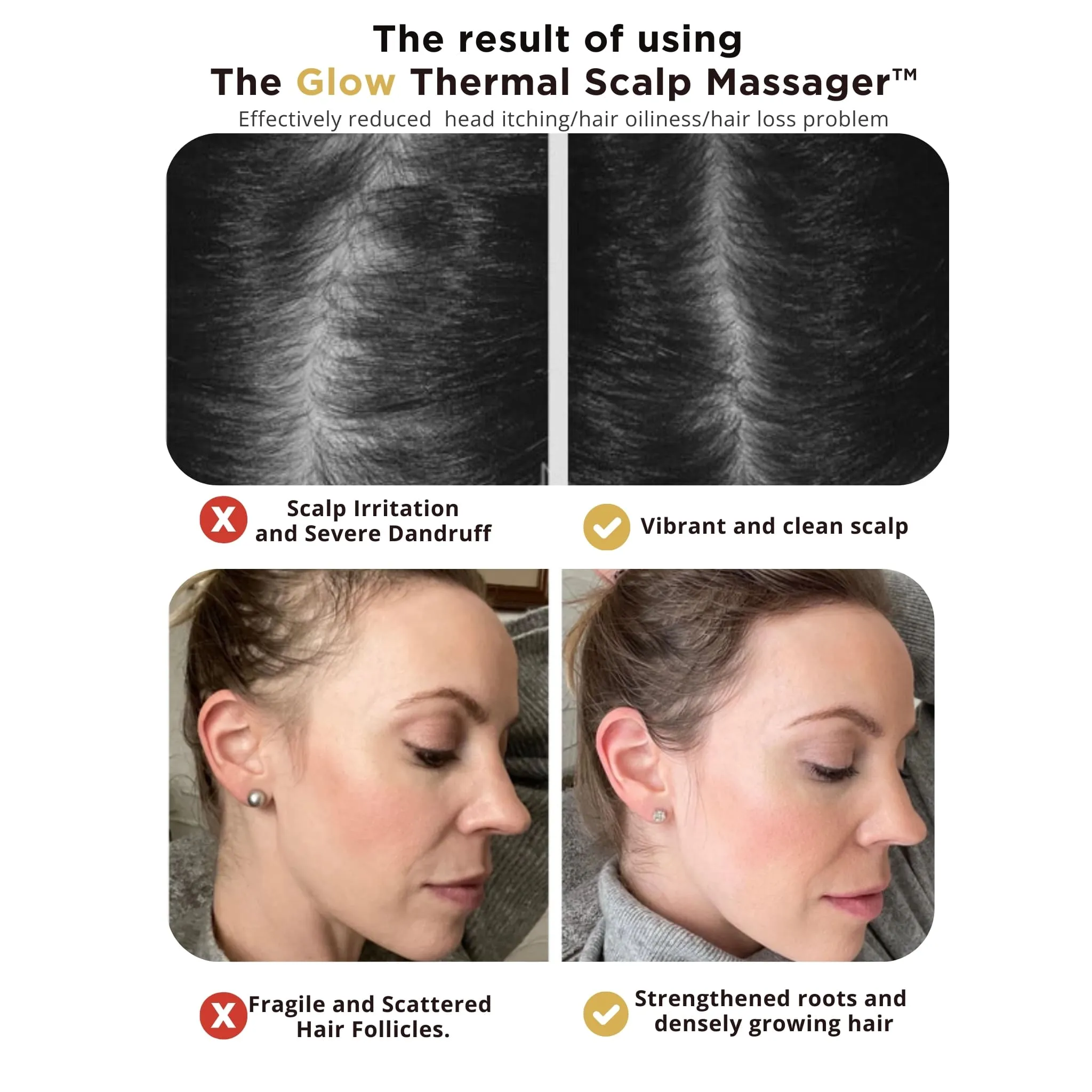 The Glow Thermal Scalp Massager™